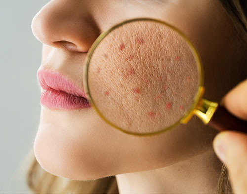 beaute_inee_index_benefit1_alt