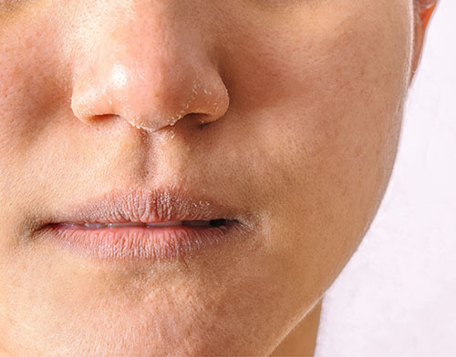 beaute_inee_index_benefit2_alt