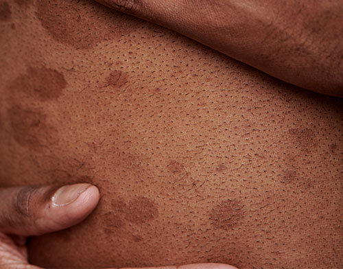 beaute_inee_index_benefit4_alt